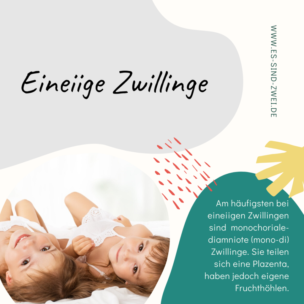 Zwillingswissen: Eineiige Zwillinge sind nicht gleich eineiige